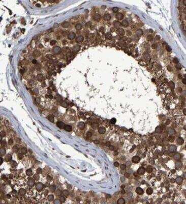 Immunohistochemistry-Paraffin: Astrin Antibody [NBP1-85262]