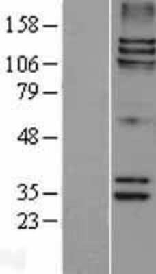 Western Blot: Astrin Overexpression Lysate [NBL1-16365]