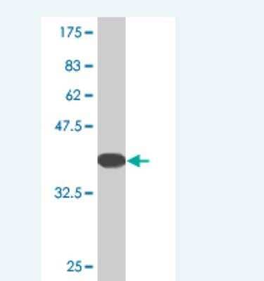 Western Blot: Ataxin 1 Antibody (4C5) [H00006310-M02]