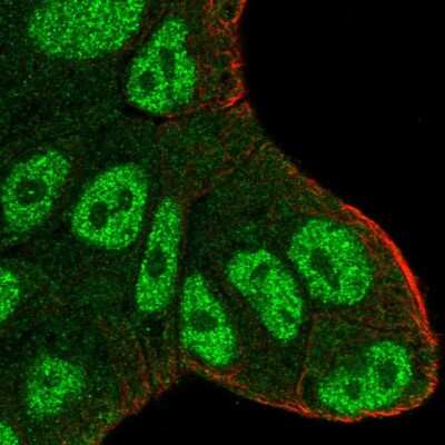 Immunocytochemistry/ Immunofluorescence: Ataxin 1 Antibody [NBP2-57735]