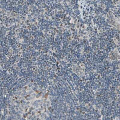 Immunohistochemistry-Paraffin: Ataxin 1 Antibody [NBP1-90065]