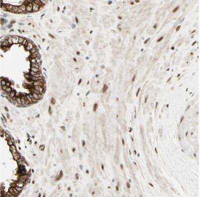 Immunohistochemistry-Paraffin: Ataxin 1 Antibody [NBP1-90065]