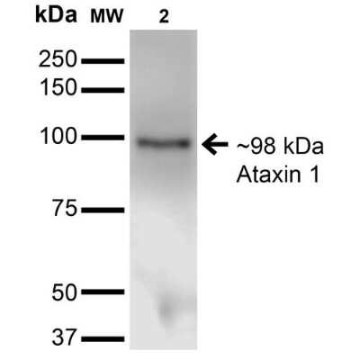 Western Blot: Ataxin 1 Antibody (S65-37) [NBP2-42204]