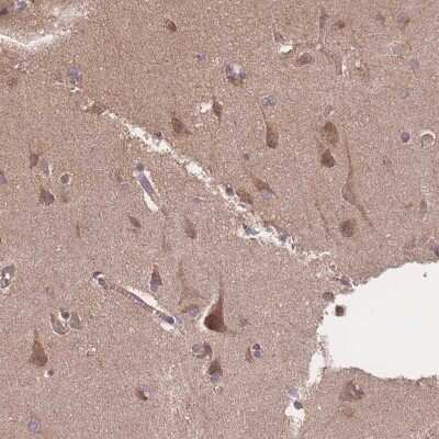 Immunohistochemistry-Paraffin: Ataxin-10 Antibody [NBP2-14336]