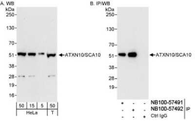 Immunoprecipitation: Ataxin-10 Antibody [NB100-57492]