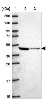 Western Blot: Ataxin-10 Antibody [NBP2-14336]