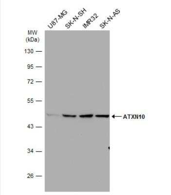 Western Blot: Ataxin-10 Antibody [NBP2-15493]