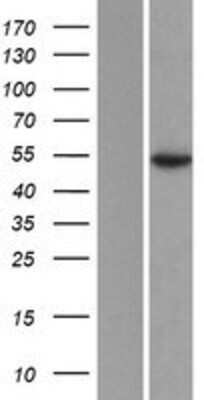 Western Blot: Ataxin-10 Overexpression Lysate [NBP2-10349]