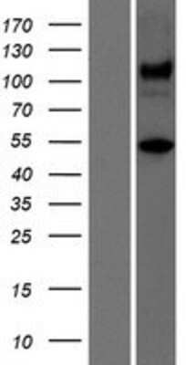 Western Blot: Ataxin-10 Overexpression Lysate [NBP2-11465]