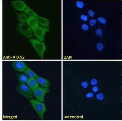 Immunocytochemistry/ Immunofluorescence: Ataxin-2 Antibody [NBP2-76807]