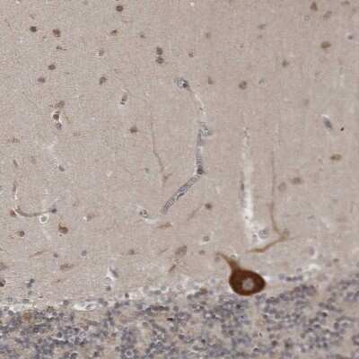 Immunohistochemistry-Paraffin: Ataxin-2 Antibody [NBP1-90062]