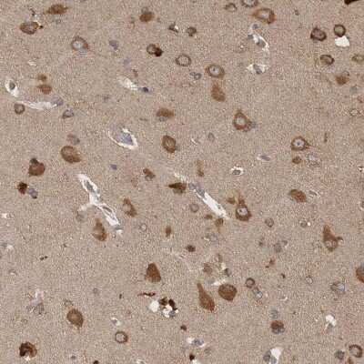 Immunohistochemistry-Paraffin: Ataxin-2 Antibody [NBP1-90062]