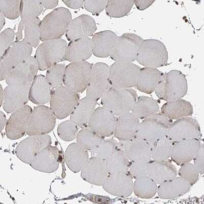 Immunohistochemistry-Paraffin: Ataxin-2 Antibody [NBP1-90062]