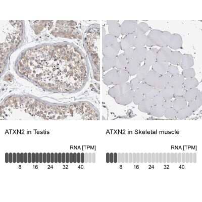 Immunohistochemistry-Paraffin: Ataxin-2 Antibody [NBP1-90063]