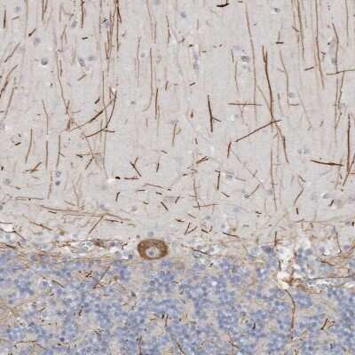 Immunohistochemistry-Paraffin: Ataxin-2 Antibody [NBP1-90063]