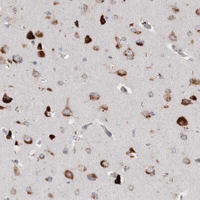 Immunohistochemistry-Paraffin: Ataxin-2 Antibody [NBP1-90063]