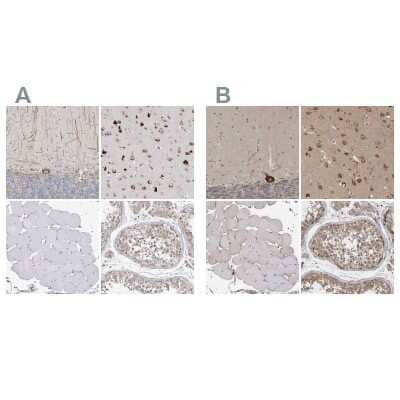 Immunohistochemistry-Paraffin: Ataxin-2 Antibody [NBP1-90063]