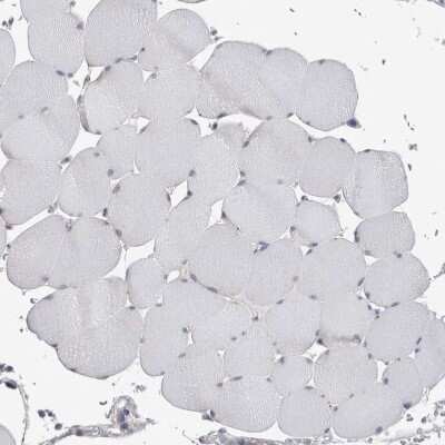 Immunohistochemistry-Paraffin: Ataxin-2 Antibody [NBP1-90063]