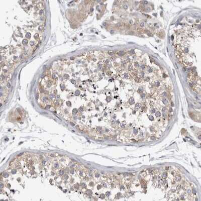 Immunohistochemistry-Paraffin: Ataxin-2 Antibody [NBP1-90063]