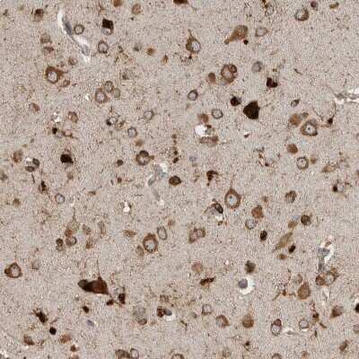 Immunohistochemistry-Paraffin: Ataxin-2 Antibody [NBP1-90064]