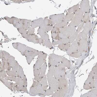 Immunohistochemistry-Paraffin: Ataxin-2 Antibody [NBP1-90064]