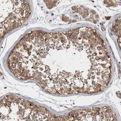 Immunohistochemistry-Paraffin: Ataxin-2 Antibody [NBP1-90064]
