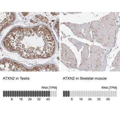 Immunohistochemistry-Paraffin: Ataxin-2 Antibody [NBP1-90064]