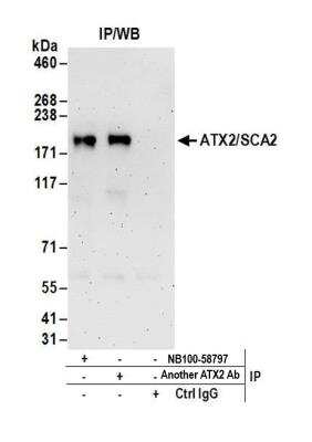 Immunoprecipitation: Ataxin-2 Antibody [NB100-58797]
