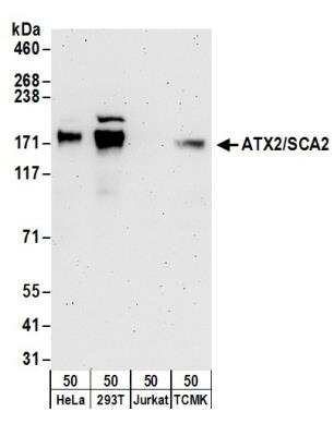 Western Blot: Ataxin-2 Antibody [NB100-58797]