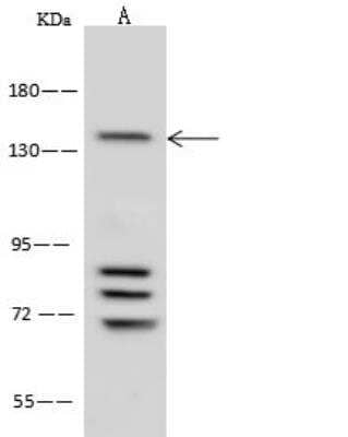 Western Blot: Ataxin-2 Antibody [NBP2-99562]