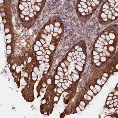 Immunohistochemistry-Paraffin: Ataxin-2-like protein Antibody [NBP2-48741]