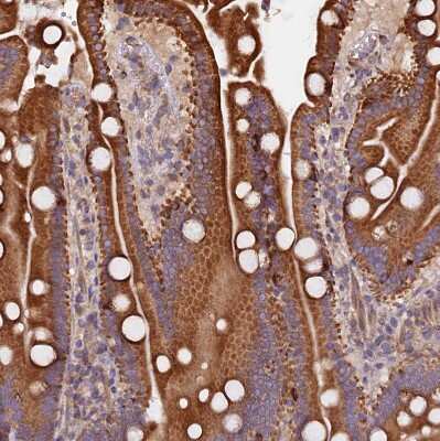 Immunohistochemistry-Paraffin: Ataxin-2-like protein Antibody [NBP2-48741]