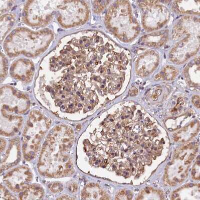 Immunohistochemistry-Paraffin: Ataxin-2-like protein Antibody [NBP2-48741]