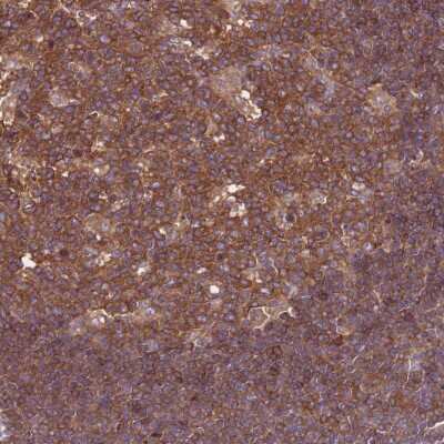 Immunohistochemistry-Paraffin: Ataxin-2-like protein Antibody [NBP2-48790]