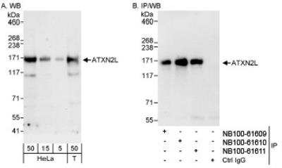 Western Blot: Ataxin-2-like protein Antibody [NB100-61609]