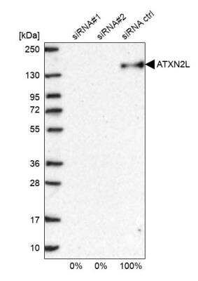 Western Blot: Ataxin-2-like protein Antibody [NBP2-48741]