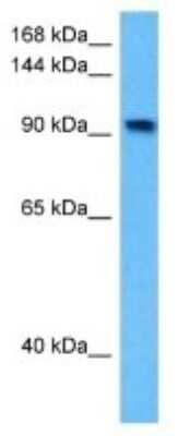 Western Blot: Ataxin-2-like protein Antibody [NBP3-10806]