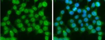 Immunocytochemistry/ Immunofluorescence: Ataxin-3 Antibody [NBP1-32083]