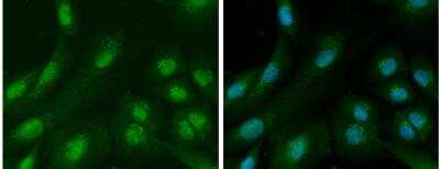 Immunocytochemistry/ Immunofluorescence: Ataxin-3 Antibody [NBP1-32083]