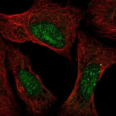 Immunocytochemistry/ Immunofluorescence: Ataxin-3 Antibody [NBP2-56452]