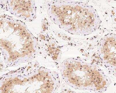 Immunohistochemistry-Paraffin: Ataxin-3 Antibody [NBP3-12686]