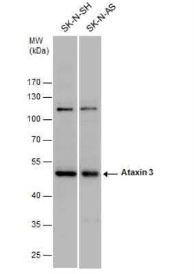 Western Blot: Ataxin-3 Antibody [NBP1-32083]