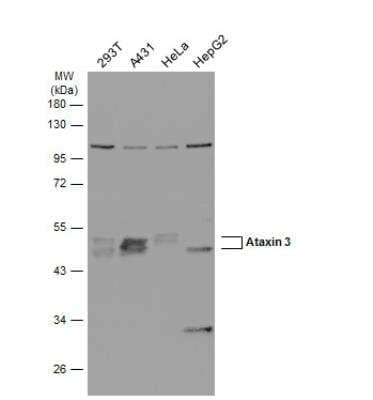 Western Blot: Ataxin-3 Antibody [NBP1-32083]