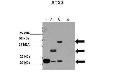 Western Blot: Ataxin-3 Antibody [NBP2-87047]