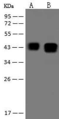 Western Blot: Ataxin-3 Antibody [NBP3-12686]