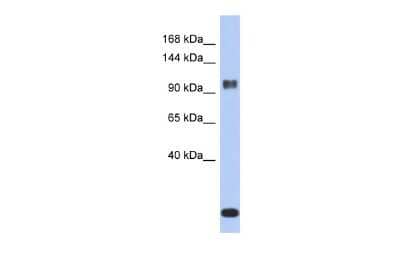 Western Blot: Ataxin 7 Antibody [NBP2-83942]