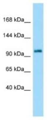 Western Blot: Ataxin 7 Antibody [NBP3-10469]