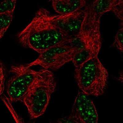 Immunocytochemistry/ Immunofluorescence: Ataxin 7-Like 3 Antibody [NBP2-56183]