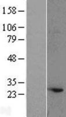 Western Blot: ATG10 Overexpression Lysate [NBL1-07794]