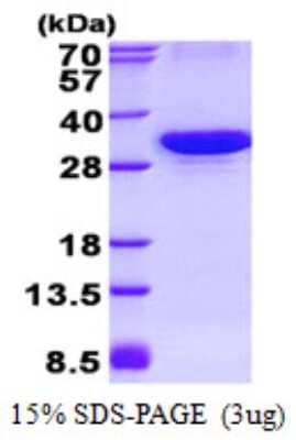 SDS-PAGE: Recombinant Human ATG10 His Protein [NBP2-22702]